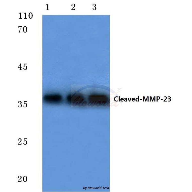 Anti-Cleaved-MMP-23 (Y79) Antibody from Bioworld Technology (BS7054) - Antibodies.com