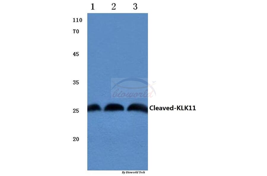 Anti-Cleaved-KLK11 (I54) Antibody from Bioworld Technology (BS7059) - Antibodies.com