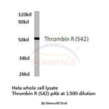 Anti-Thrombin R (S42) Antibody from Bioworld Technology (BS7067) - Antibodies.com