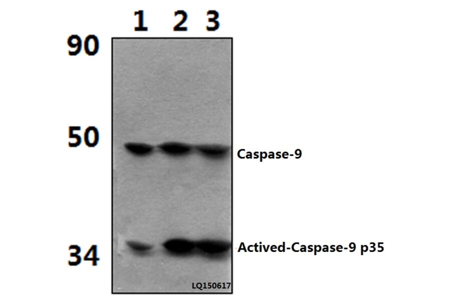 Anti-Actived-Caspase-9 p35 (D315) Antibody from Bioworld Technology (BS7070) - Antibodies.com