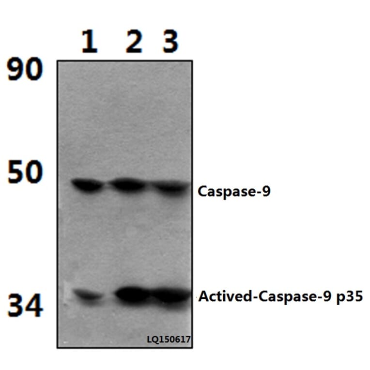 Anti-Actived-Caspase-9 p35 (D315) Antibody from Bioworld Technology (BS7070) - Antibodies.com