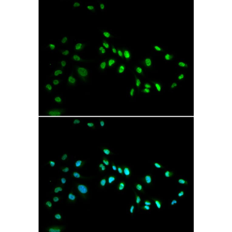 Anti-DNMT3A Antibody from Bioworld Technology (BS7101) - Antibodies.com