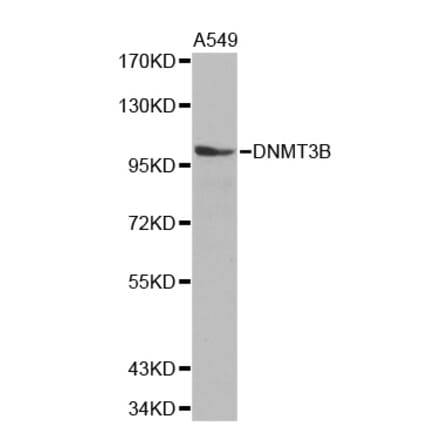 Anti-DNMT3B Antibody from Bioworld Technology (BS7102) - Antibodies.com