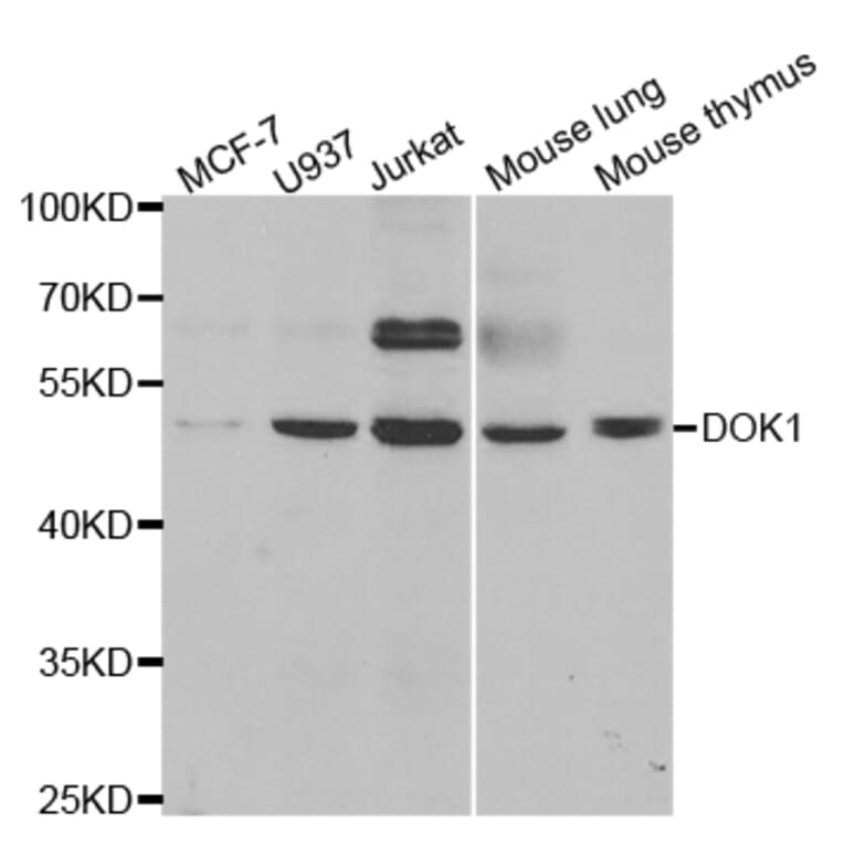 Anti-Dok-1 Antibody from Bioworld Technology (BS7103) - Antibodies.com