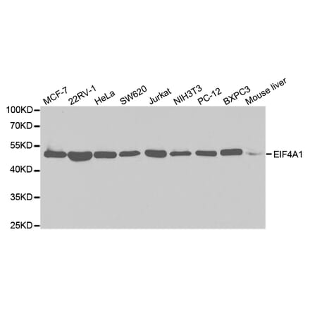 Anti-eIF4A1 Antibody from Bioworld Technology (BS7106) - Antibodies.com