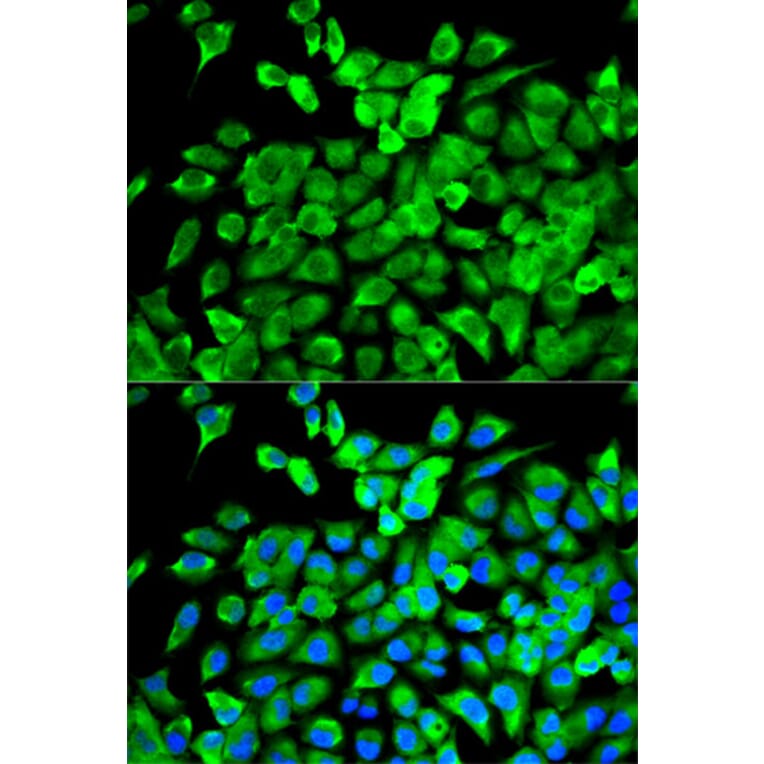 Anti-eIF4A1 Antibody from Bioworld Technology (BS7106) - Antibodies.com