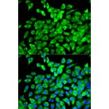 Anti-eIF4A1 Antibody from Bioworld Technology (BS7106) - Antibodies.com