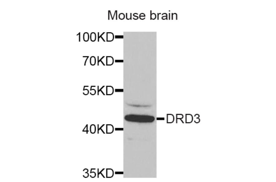 Anti-DRD3 Antibody from Bioworld Technology (BS7107) - Antibodies.com