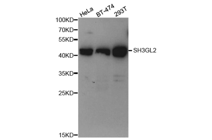 Anti-Endophilin I Antibody from Bioworld Technology (BS7108) - Antibodies.com