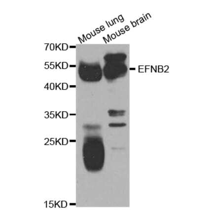 Anti-Ephrin-B2 Antibody from Bioworld Technology (BS7112) - Antibodies.com