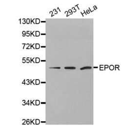 Anti-EpoR Antibody from Bioworld Technology (BS7113) - Antibodies.com