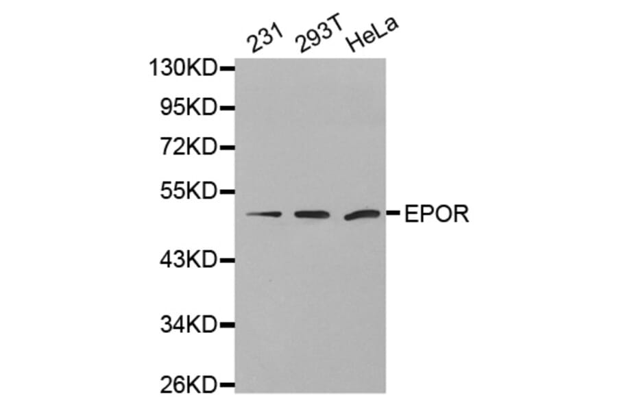 Anti-EpoR Antibody from Bioworld Technology (BS7113) - Antibodies.com