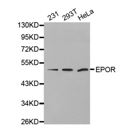 Anti-EpoR Antibody from Bioworld Technology (BS7113) - Antibodies.com