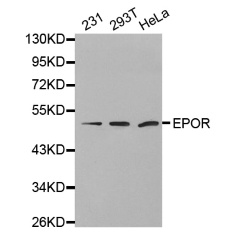 Anti-EpoR Antibody from Bioworld Technology (BS7113) - Antibodies.com