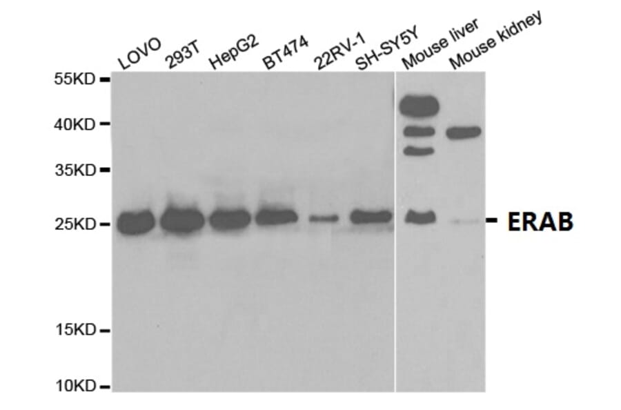 Anti-ERAB Antibody from Bioworld Technology (BS7114) - Antibodies.com
