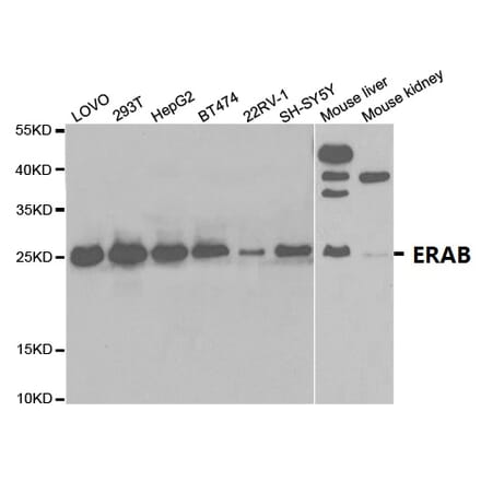 Anti-ERAB Antibody from Bioworld Technology (BS7114) - Antibodies.com