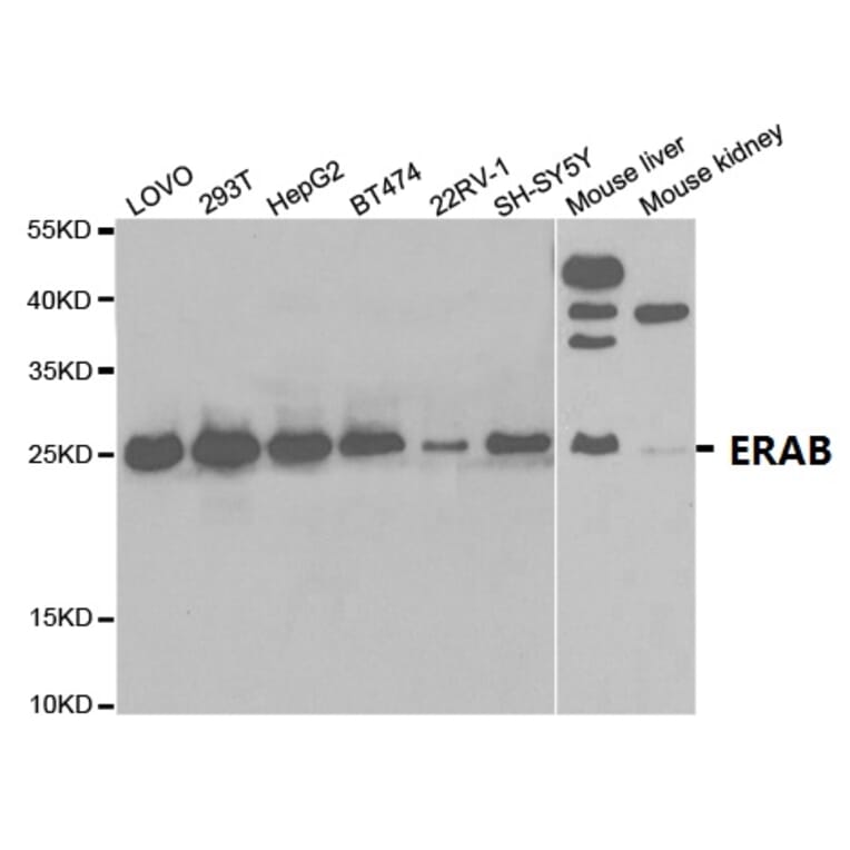 Anti-ERAB Antibody from Bioworld Technology (BS7114) - Antibodies.com