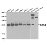 Anti-ERAB Antibody from Bioworld Technology (BS7114) - Antibodies.com