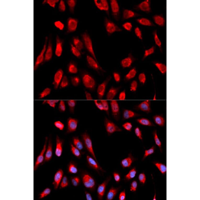 Anti-ERAB Antibody from Bioworld Technology (BS7114) - Antibodies.com