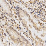Anti-Fes Antibody from Bioworld Technology (BS7116) - Antibodies.com