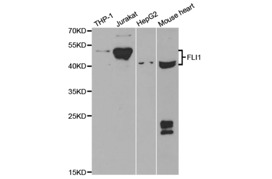 Anti-Fli-1 Antibody from Bioworld Technology (BS7117) - Antibodies.com
