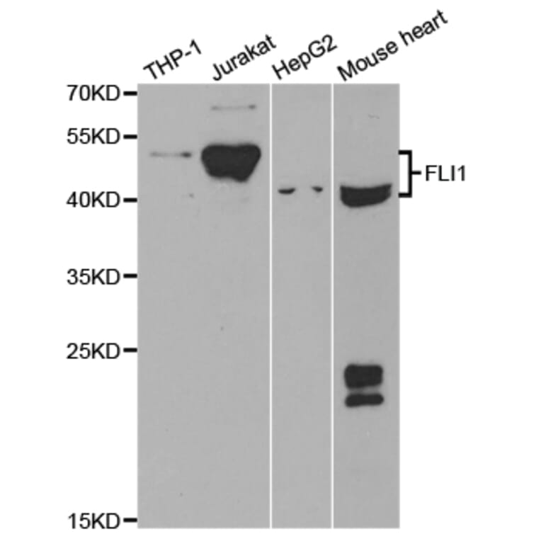 Anti-Fli-1 Antibody from Bioworld Technology (BS7117) - Antibodies.com