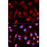 Anti-Fli-1 Antibody from Bioworld Technology (BS7117) - Antibodies.com