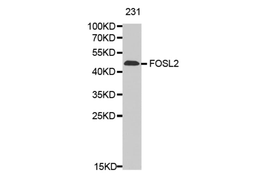 Anti-FOSL2 Antibody from Bioworld Technology (BS7119) - Antibodies.com