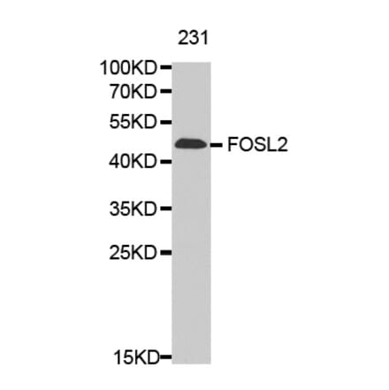 Anti-FOSL2 Antibody from Bioworld Technology (BS7119) - Antibodies.com
