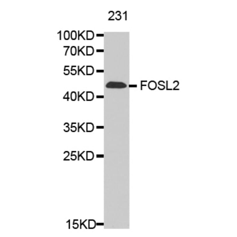 Anti-FOSL2 Antibody from Bioworld Technology (BS7119) - Antibodies.com