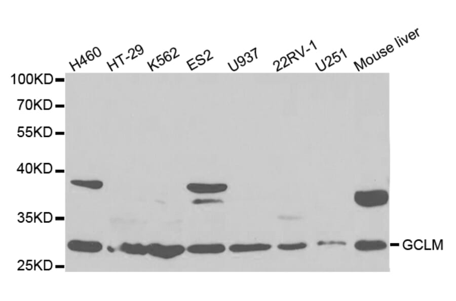 Anti-GCSm-γ Antibody from Bioworld Technology (BS7121) - Antibodies.com