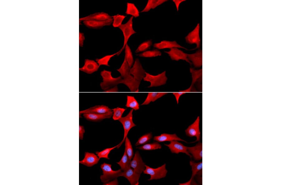 Anti-GCSm-γ Antibody from Bioworld Technology (BS7121) - Antibodies.com