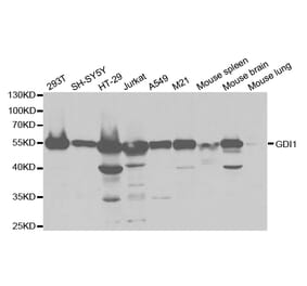 Anti-GDI1 Antibody from Bioworld Technology (BS7123) - Antibodies.com