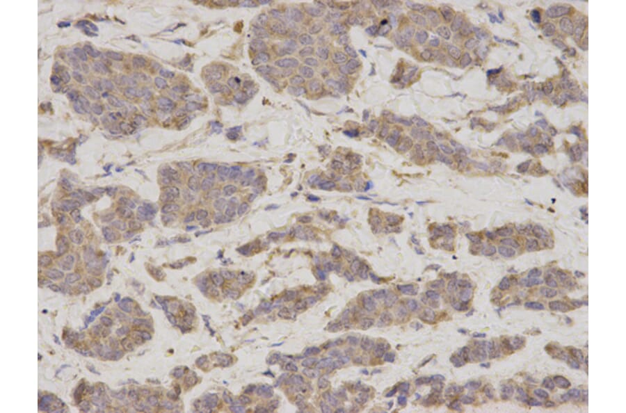 Anti-GDI1 Antibody from Bioworld Technology (BS7123) - Antibodies.com