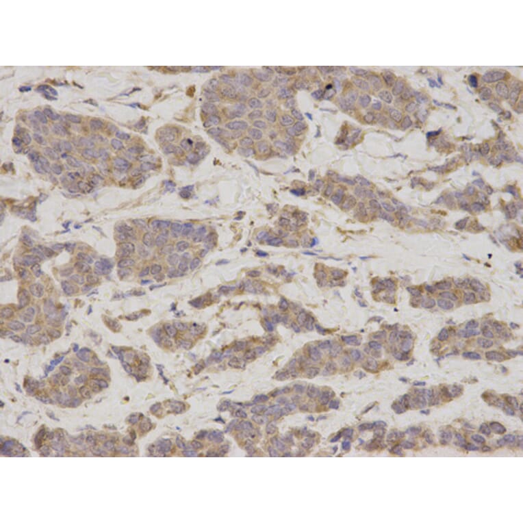 Anti-GDI1 Antibody from Bioworld Technology (BS7123) - Antibodies.com