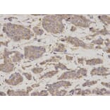 Anti-GDI1 Antibody from Bioworld Technology (BS7123) - Antibodies.com