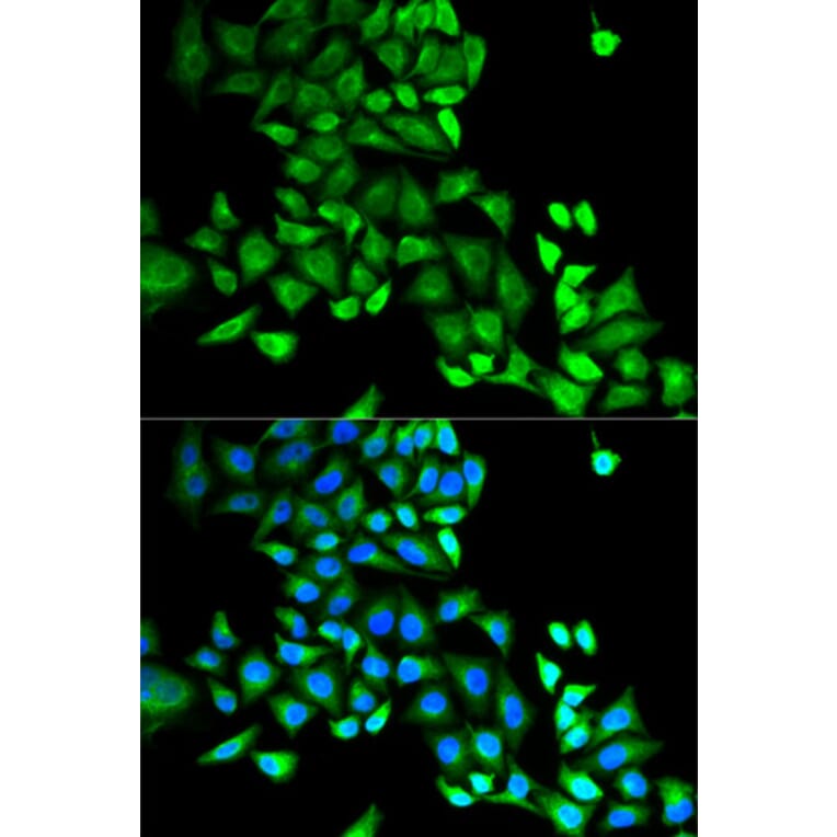 Anti-GDI1 Antibody from Bioworld Technology (BS7123) - Antibodies.com