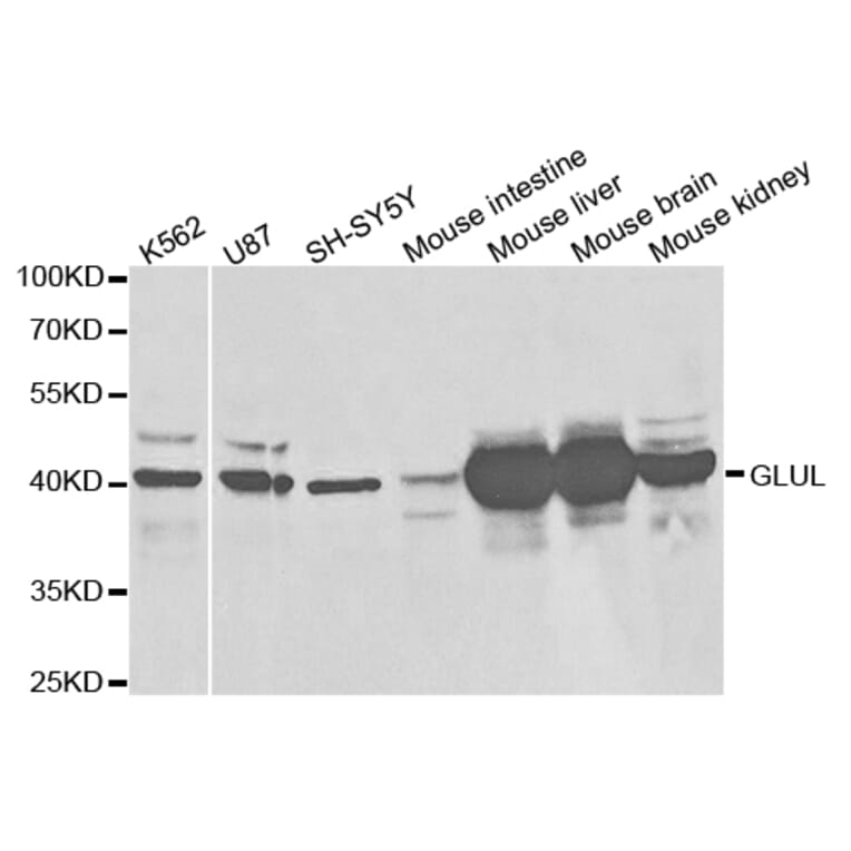 Anti-GLUL Antibody from Bioworld Technology (BS7124) - Antibodies.com