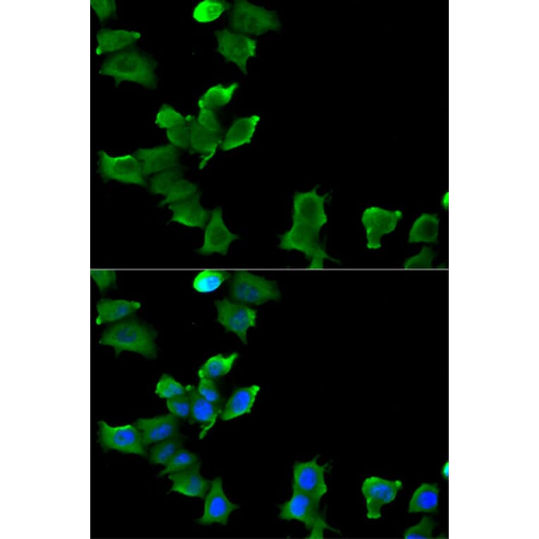 Anti-GLUL Antibody from Bioworld Technology (BS7124) - Antibodies.com