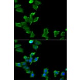 Anti-GLUL Antibody from Bioworld Technology (BS7124) - Antibodies.com
