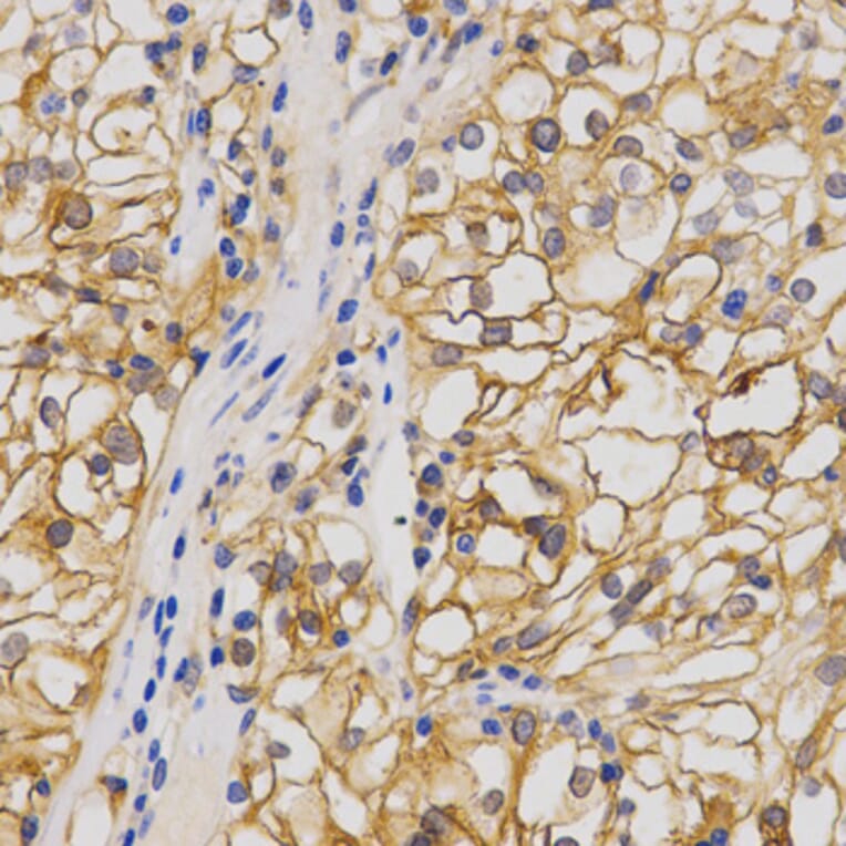 Anti-GluR1 Antibody from Bioworld Technology (BS7125) - Antibodies.com