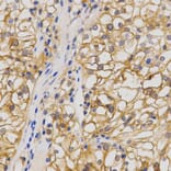 Anti-GluR1 Antibody from Bioworld Technology (BS7125) - Antibodies.com