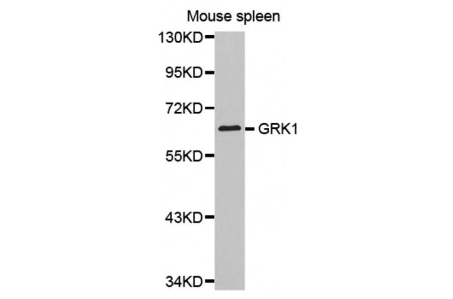 Anti-GRK1 Antibody from Bioworld Technology (BS7127) - Antibodies.com