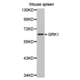 Anti-GRK1 Antibody from Bioworld Technology (BS7127) - Antibodies.com