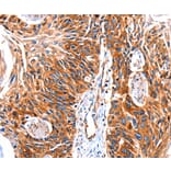 Anti-GRK1 Antibody from Bioworld Technology (BS7127) - Antibodies.com
