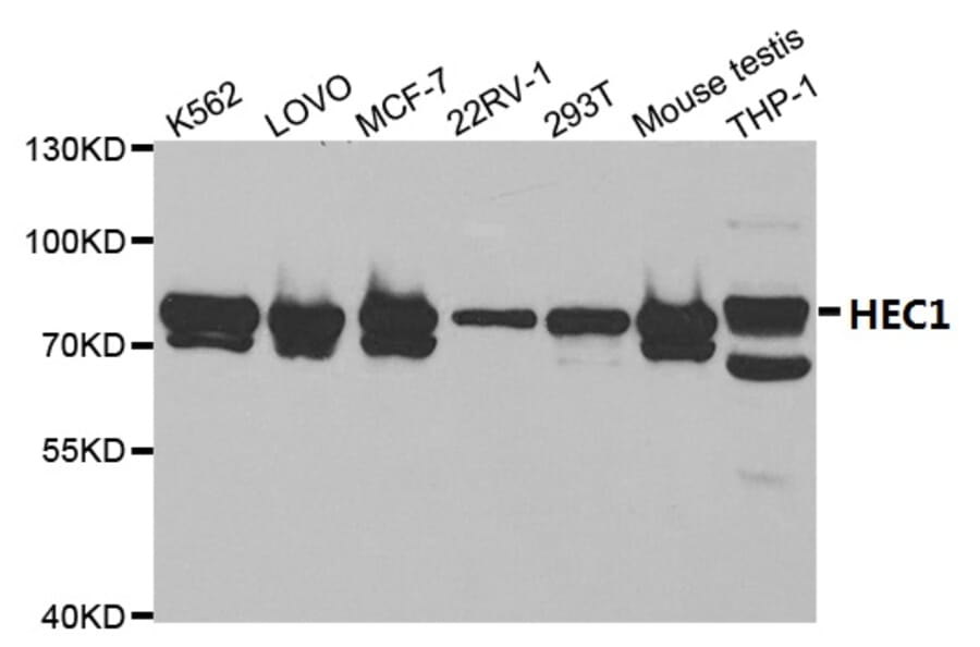 Anti-HEC1 Antibody from Bioworld Technology (BS7130) - Antibodies.com