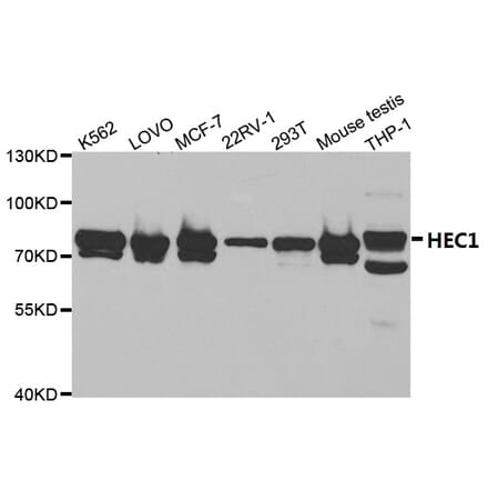Anti-HEC1 Antibody from Bioworld Technology (BS7130) - Antibodies.com