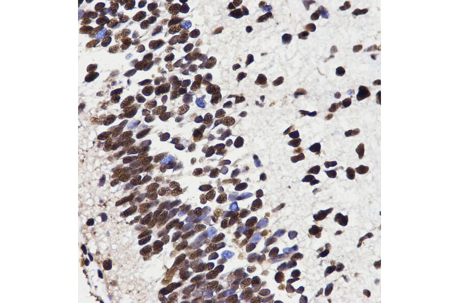 Anti-HMGB1 Antibody from Bioworld Technology (BS7131) - Antibodies.com