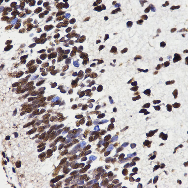 Anti-HMGB1 Antibody from Bioworld Technology (BS7131) - Antibodies.com
