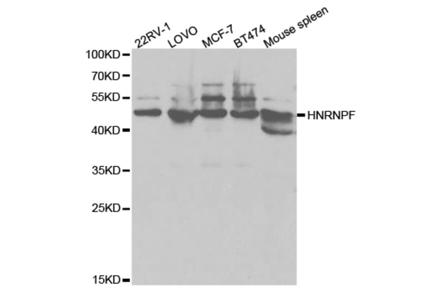 Anti-hnRNP F Antibody from Bioworld Technology (BS7133) - Antibodies.com